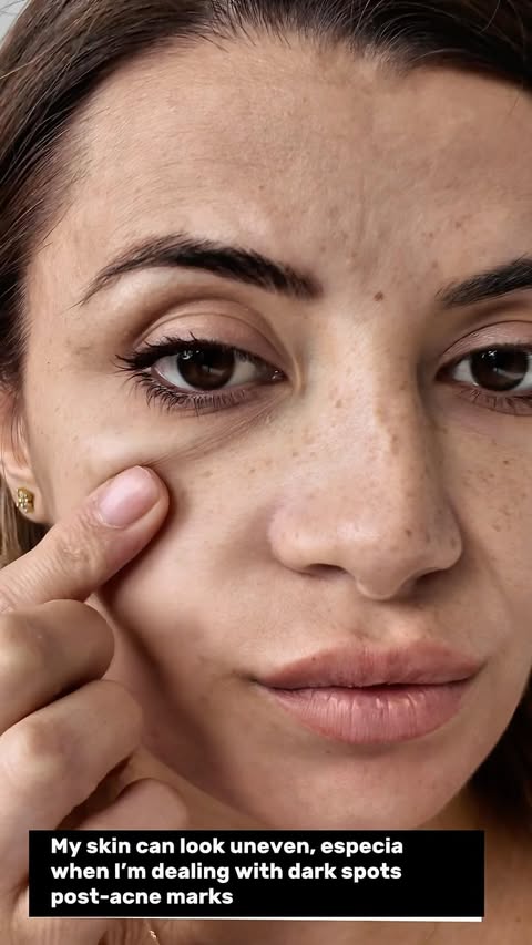 Instagram post by @mariam_giorgashvili for TIAM. Caption reads: [...] uneven skin tone? 👀✨ I’ve been using the....
