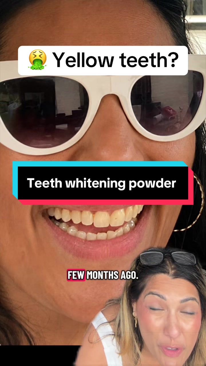 TikTok post by @sheena.tiktok76 for Icy Bear Dental. Caption reads: Whitening your teeth is so easy in 2026 @Icy Bear....