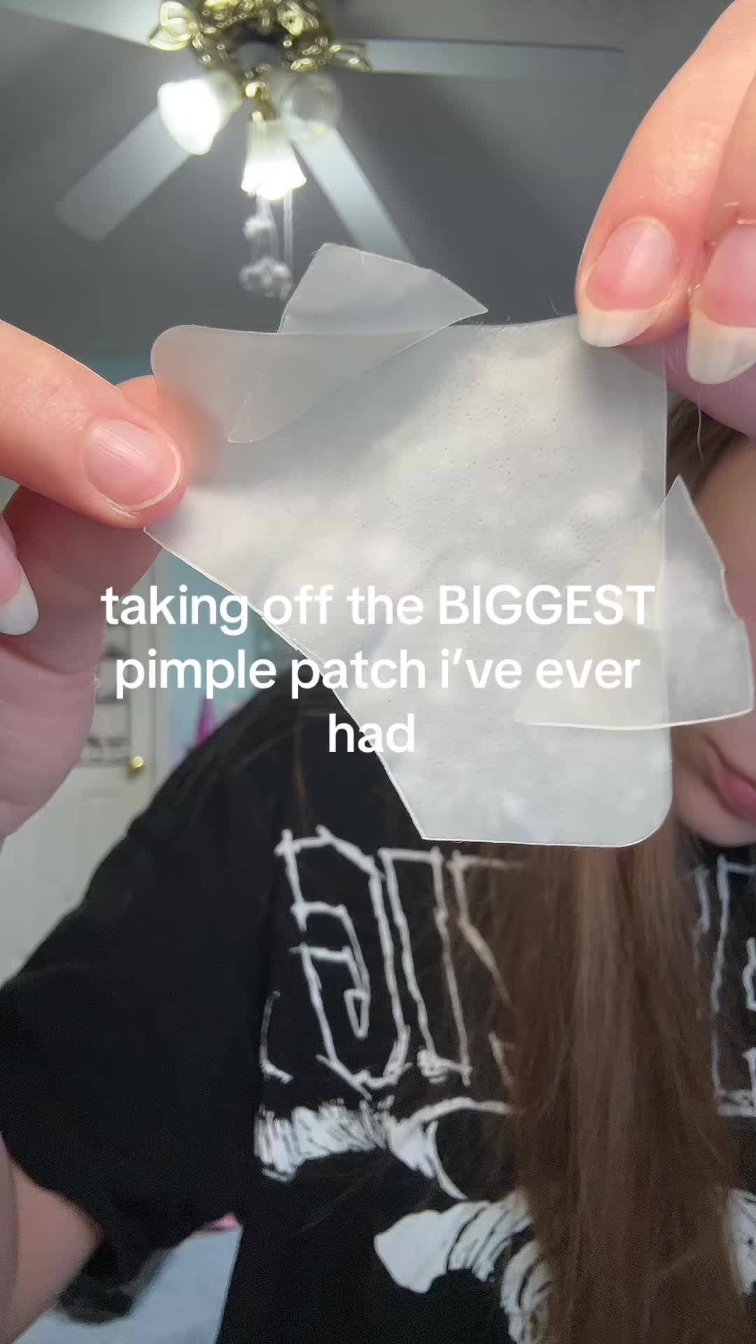 TikTok post by @kittylivvy_ for LitBear. Caption reads: [...] #fyp #pimplepatch #pimples #acne #viral....