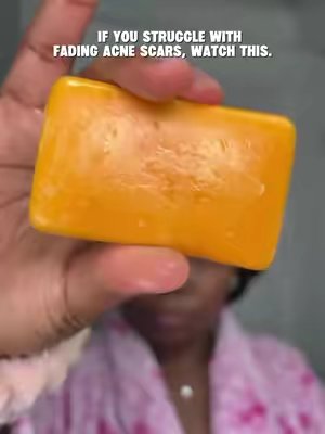 TikTok post by @prettymelaningoddess for Glo Melanin. Caption reads: Glo Melanin 🥰✨ Is more than just skincare. It’s....