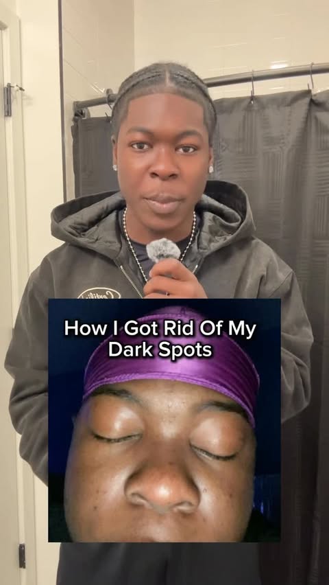 Instagram post by @certifiedjio for Good Molecules. Caption reads: How I Got Rid Of My Dark Spots , I Hope This....