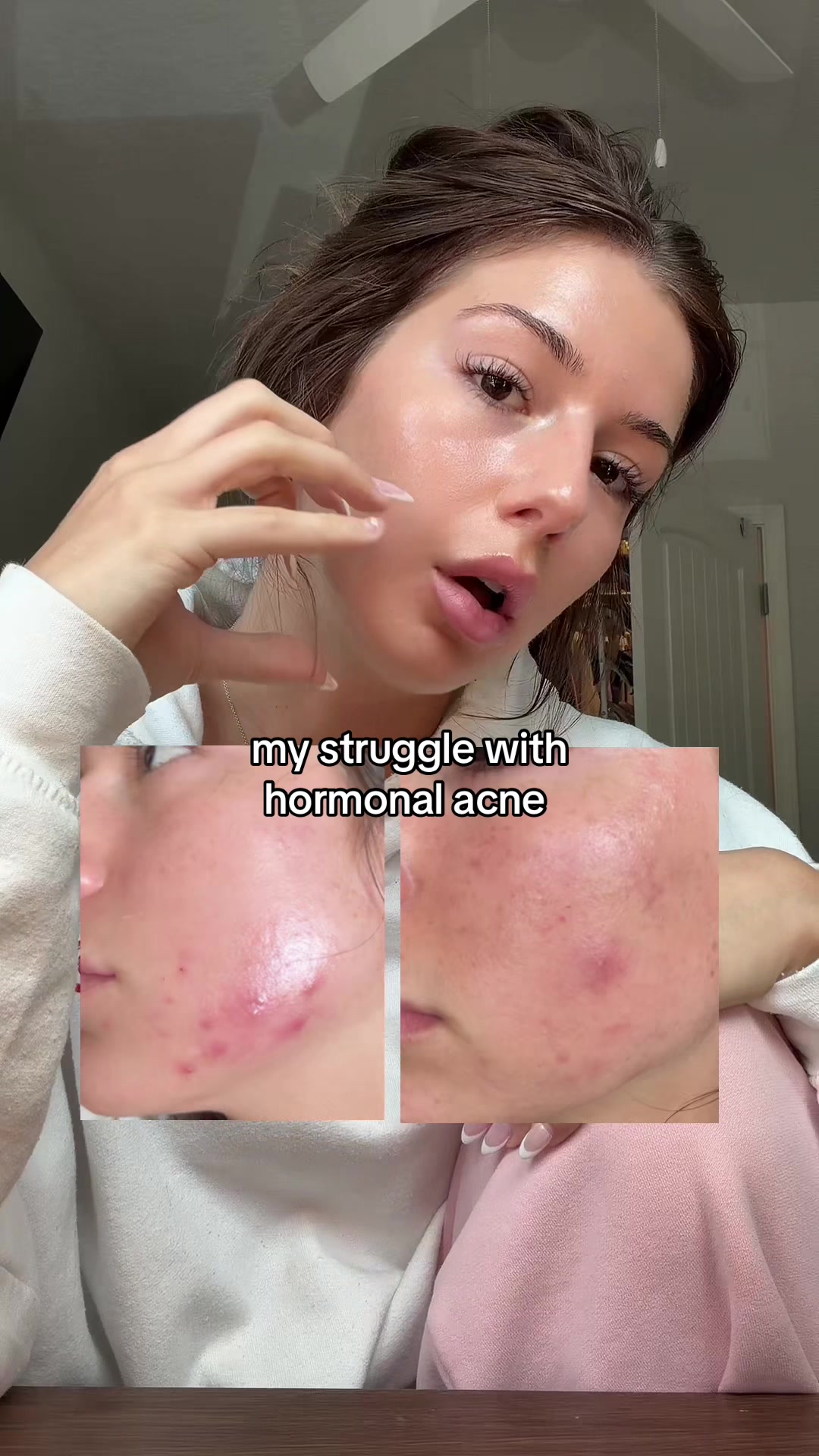 TikTok post by @kendallshops for CLEARSTEM Skincare. Caption reads: [...] #glassskin #hormonalacne @CLEARSTEM Skincare.