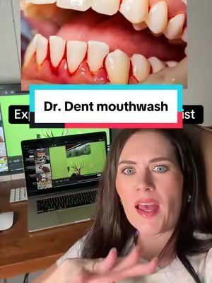 TikTok post by @selfcarehygienist for Dr Dent. Caption reads: [...] - shop #mouthwash #gingivitis #drdent....