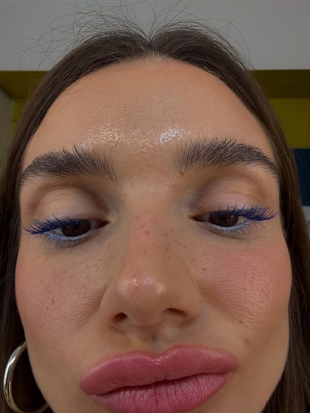 Instagram post by @aslisumen for Turkish Airlines. Caption reads: self appreciation post - having an allergic....