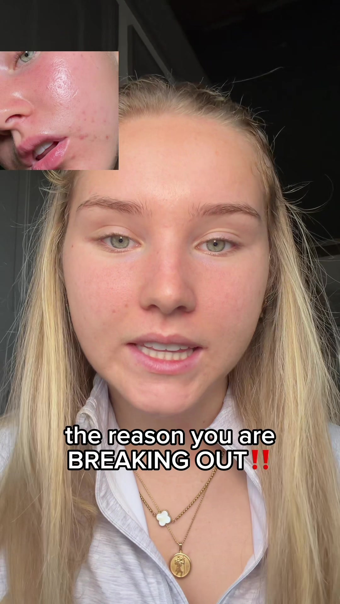 TikTok post by @lifewithmils for Free Soul. Caption reads: why you’re breaking out🫠🫠 ad product mentioned:....