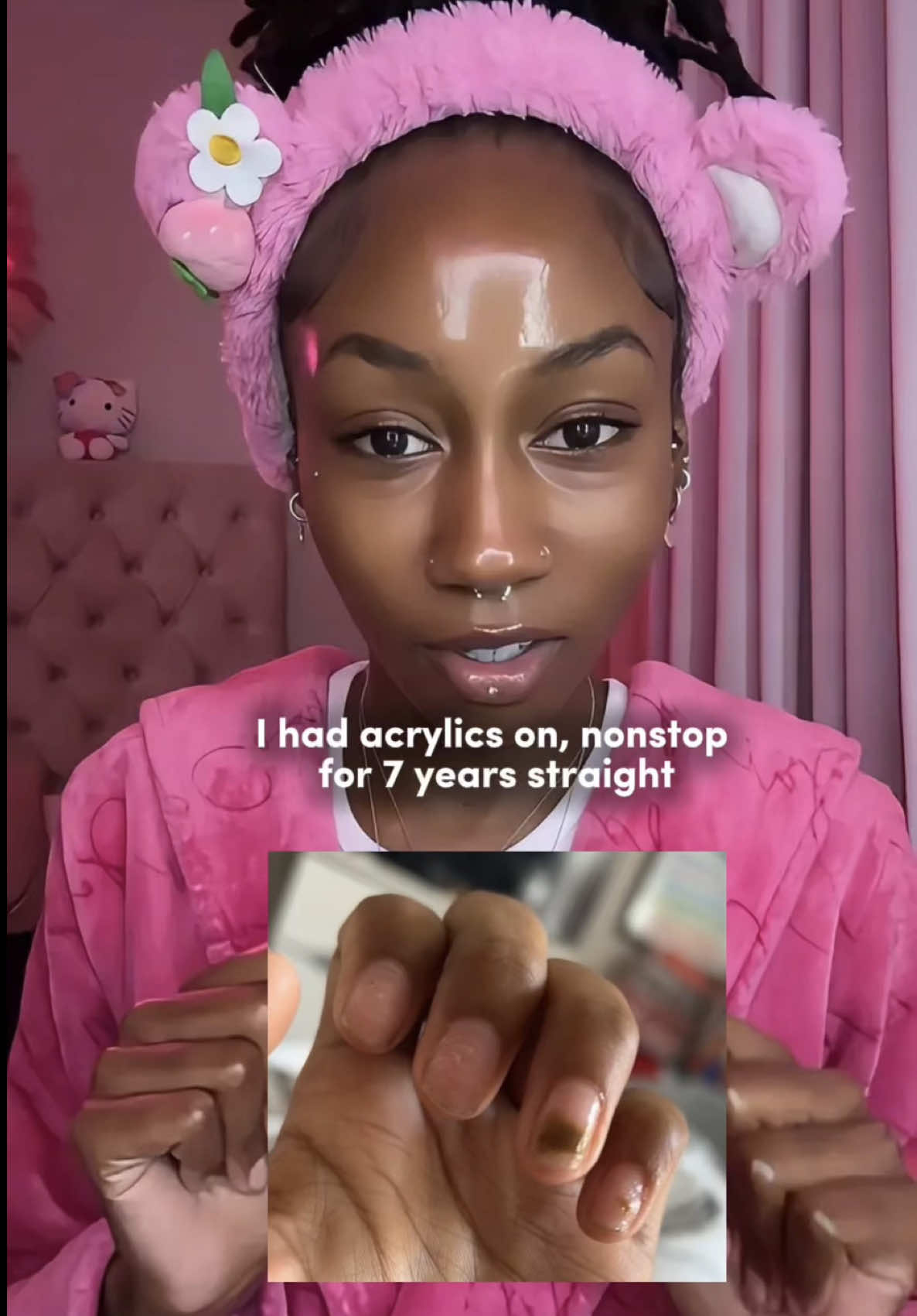 TikTok post by @candylocs for LONDONTOWN. Caption reads: [...] me get them healthy again ✨💅🏽....
