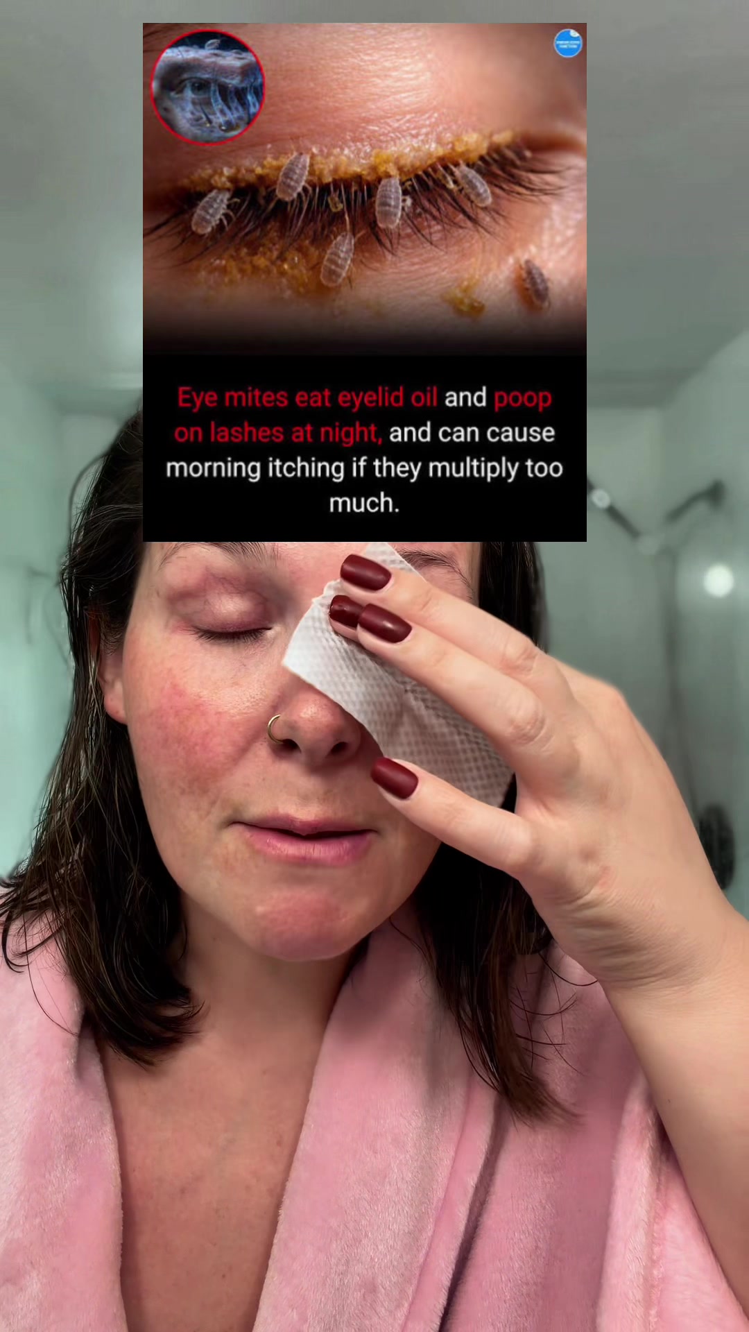 TikTok post by @thetiktokshopnurse for CorneaCare. Caption reads: [...] this is an easy place to start. @CorneaCare....