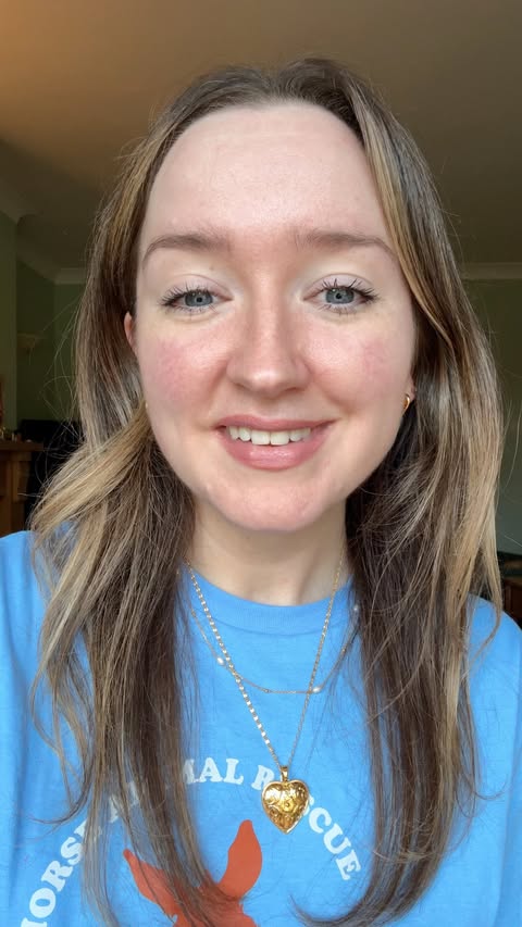 Instagram post by @rosegallagher for Theinkeylist. Caption reads: Ultimate guide to rosacea - part 2 of 4: how to....