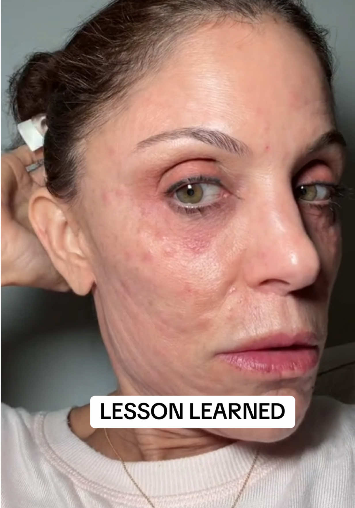 TikTok post by @bethennyfrankel for cleanskinclub. Caption reads: [...] it will save YOU. You’re Welcome.....