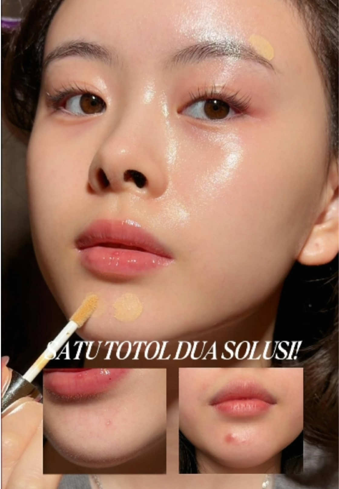 TikTok post by @clariceecutie for Nurilab.id. Caption reads: [...] pakai NEW Acne Conclearing 2.0 dari....
