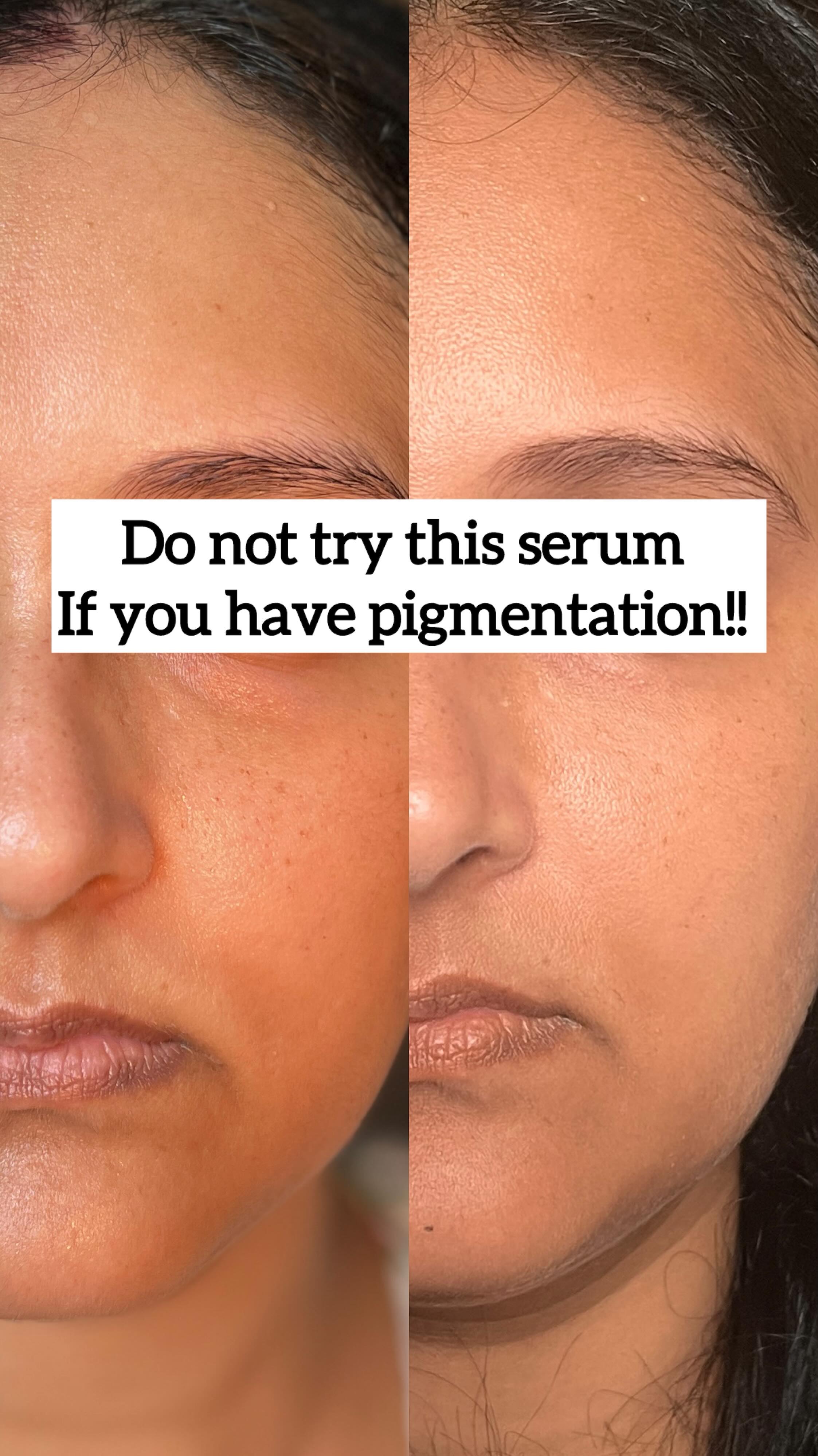 Instagram post by @a_good_skin for Juicy Chemistry. Caption reads: About the product :

This serum is lightweight in....