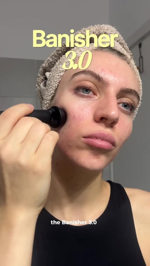 Instagram post by @ana_vaideanu for Banish. Caption reads: I’ve been comparing different microneedling....