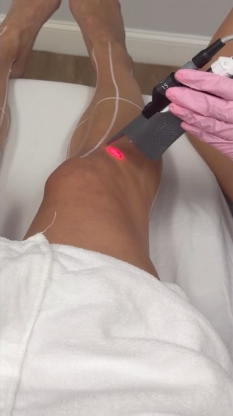 Instagram post by @evahud12 for LaserAway. Caption reads: [...] my laser hair removal journey with....