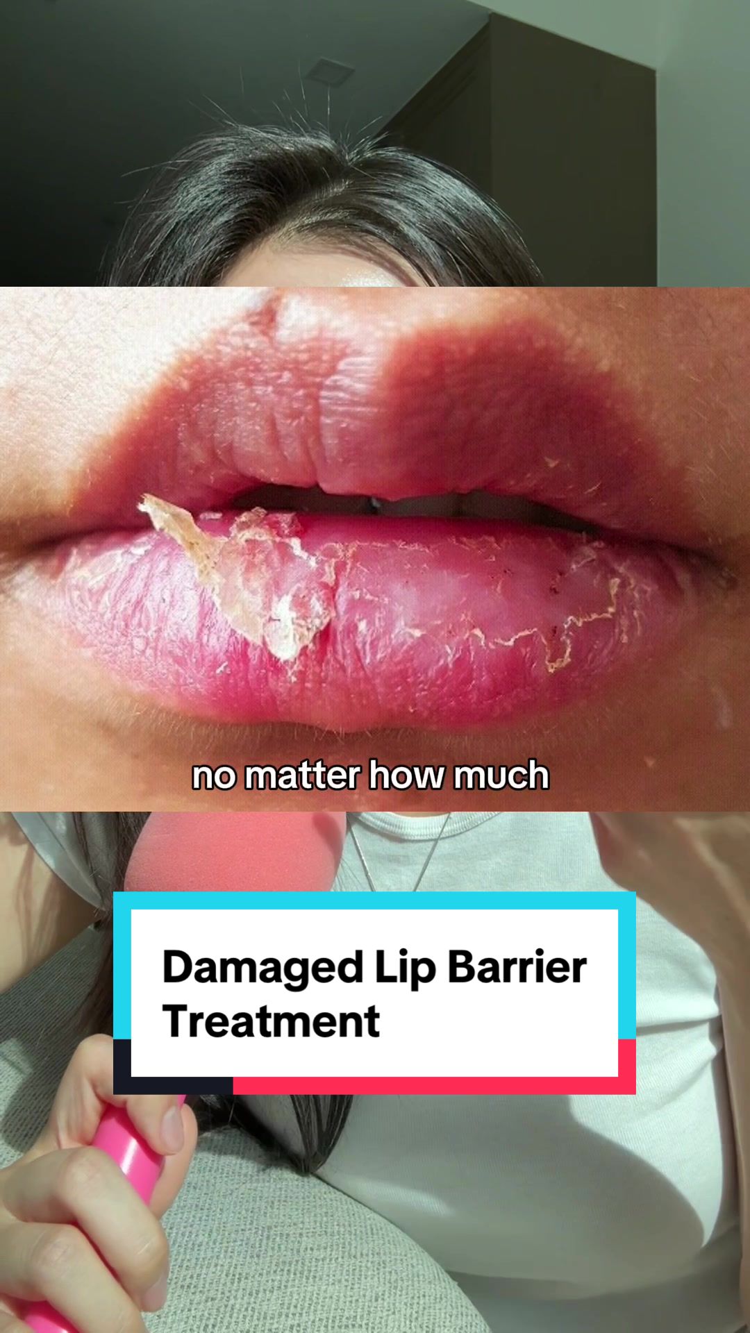 TikTok post by @mayaya.kimmm for CNP Laboratory US. Caption reads: How to treat damaged lip barrier 101☝🏻....