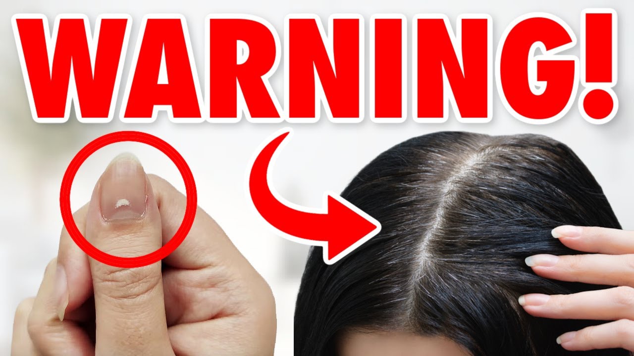 YouTube post by @SheaWhitney for LoopyCases. Caption reads: 13 Warning Signs You Shouldn't Ignore... & HOW TO....