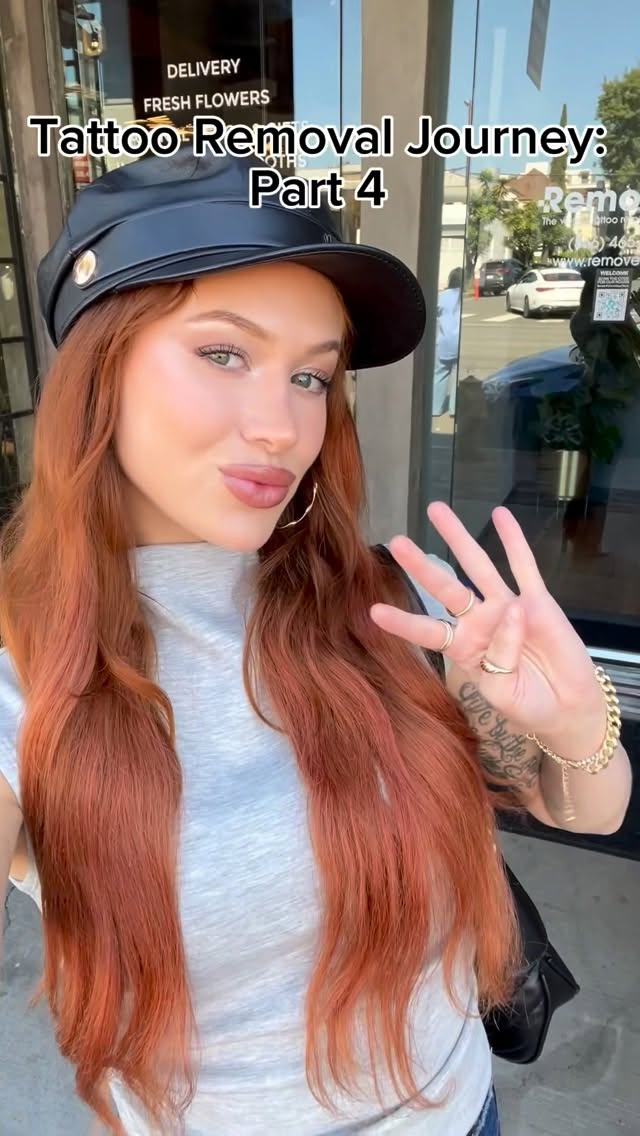 Instagram post by @summerbarkan for Removery. Caption reads: Back again for round 4 with @removery ! The....