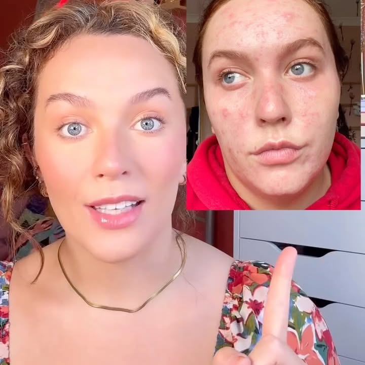 Instagram post by @levijademakeup for Dermatica. Caption reads: AD My personal skincare journey with....