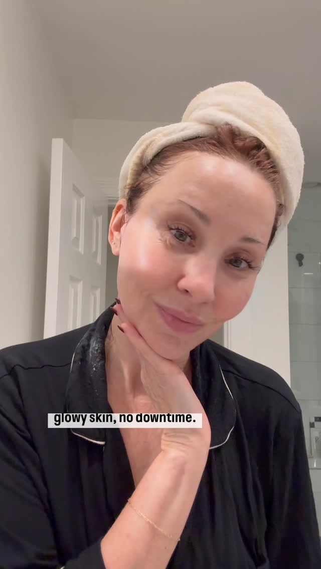 Instagram post by @themichellespieler for Exuviance. Caption reads: My last gentle peel of the year before my big TCA....