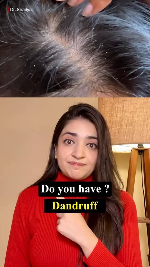 Instagram post by @doctorshailya for WishCare. Caption reads: [...] oils & curd — they make dandruff....