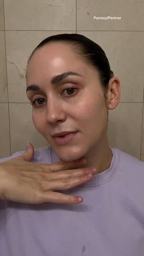 Instagram post by @jordynwoodruff for PanOxyl. Caption reads: I love using @panoxyl on my zittiest days! You can....