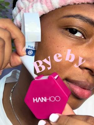 TikTok post by @karla_cdm for Hanhooskin. Caption reads: Amé estos patches para el acné de @Hanhooskin X....