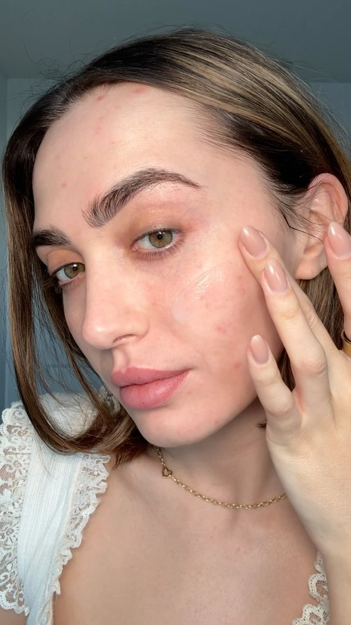 Instagram post by @ericanic0le for Face Reality. Caption reads: [...] get yours from your local Acne Expert....