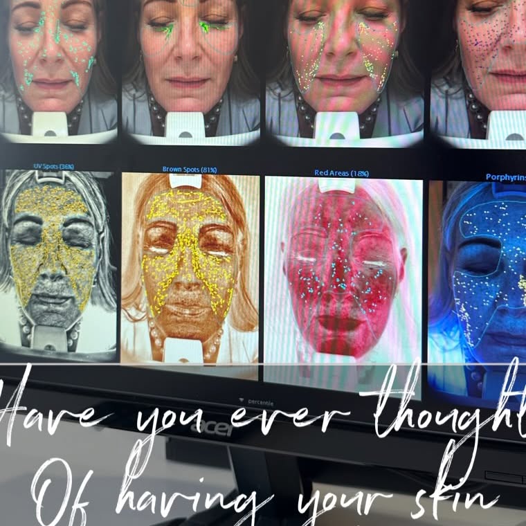 Instagram post by @40fashionandlifestyle for EC Clinic London. Caption reads: [...] to have been invited along to the....