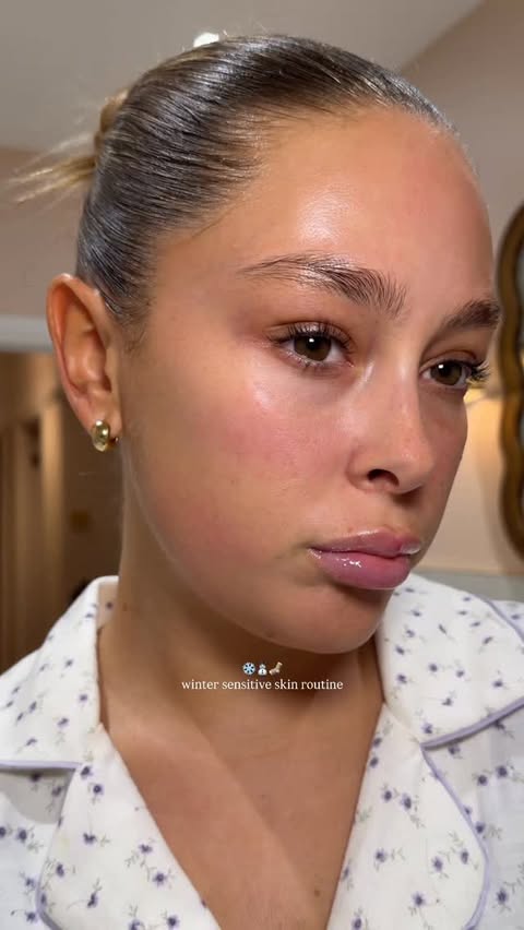 Instagram post by @skinbylottie for Kate Somerville. Caption reads: my skin is sooo dry rn bc of the season change so....