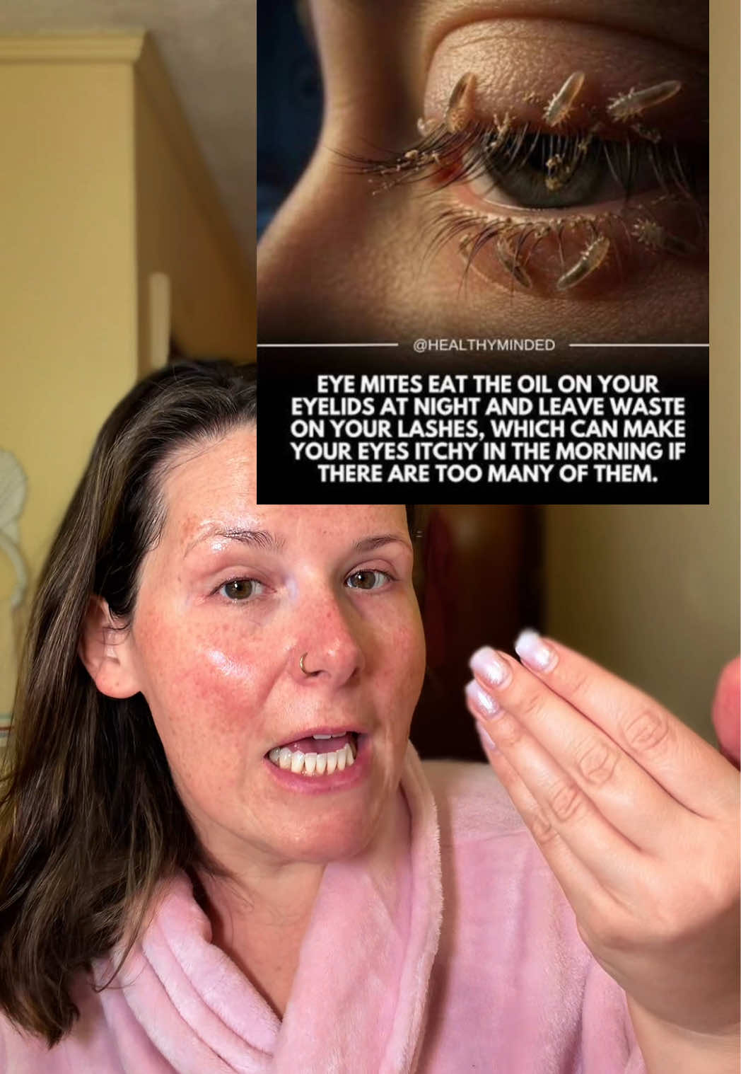 TikTok post by @thetiktokshopnurse for CorneaCare. Caption reads: [...] so much with irritation and dryness.....