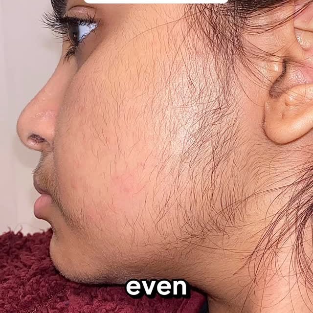 Instagram post by @samarasalvator for Ulike Global. Caption reads: Do you wanna get rid of facial hair?

This device....