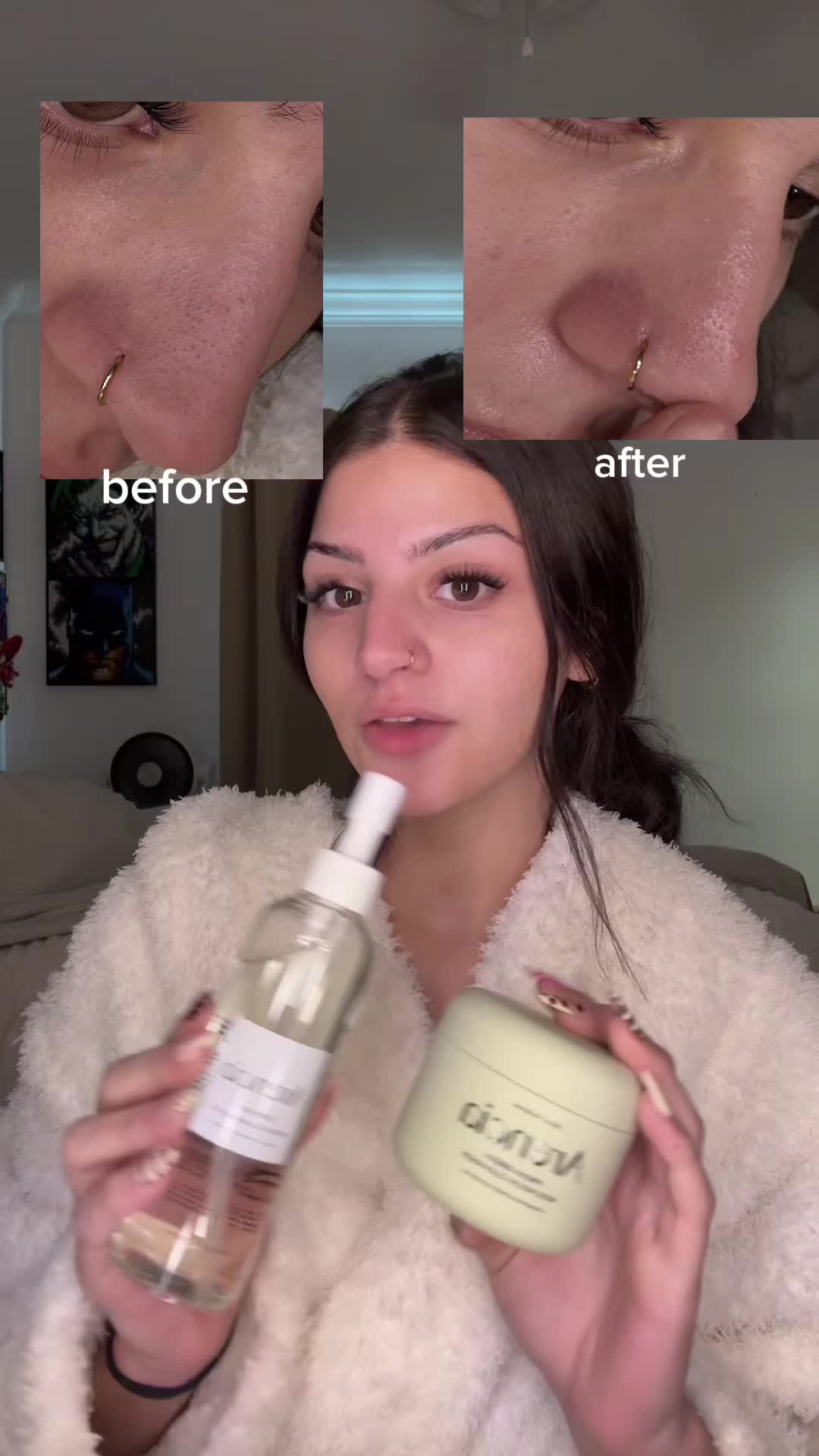 TikTok post by @keillyalons.oo for arencia. Caption reads: results are insane||@Arencia #arencia #acne....