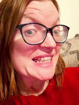 TikTok post by @em_ben20 for Burst Oral Care. Caption reads: [...] my teeth this evening after using @BURST....