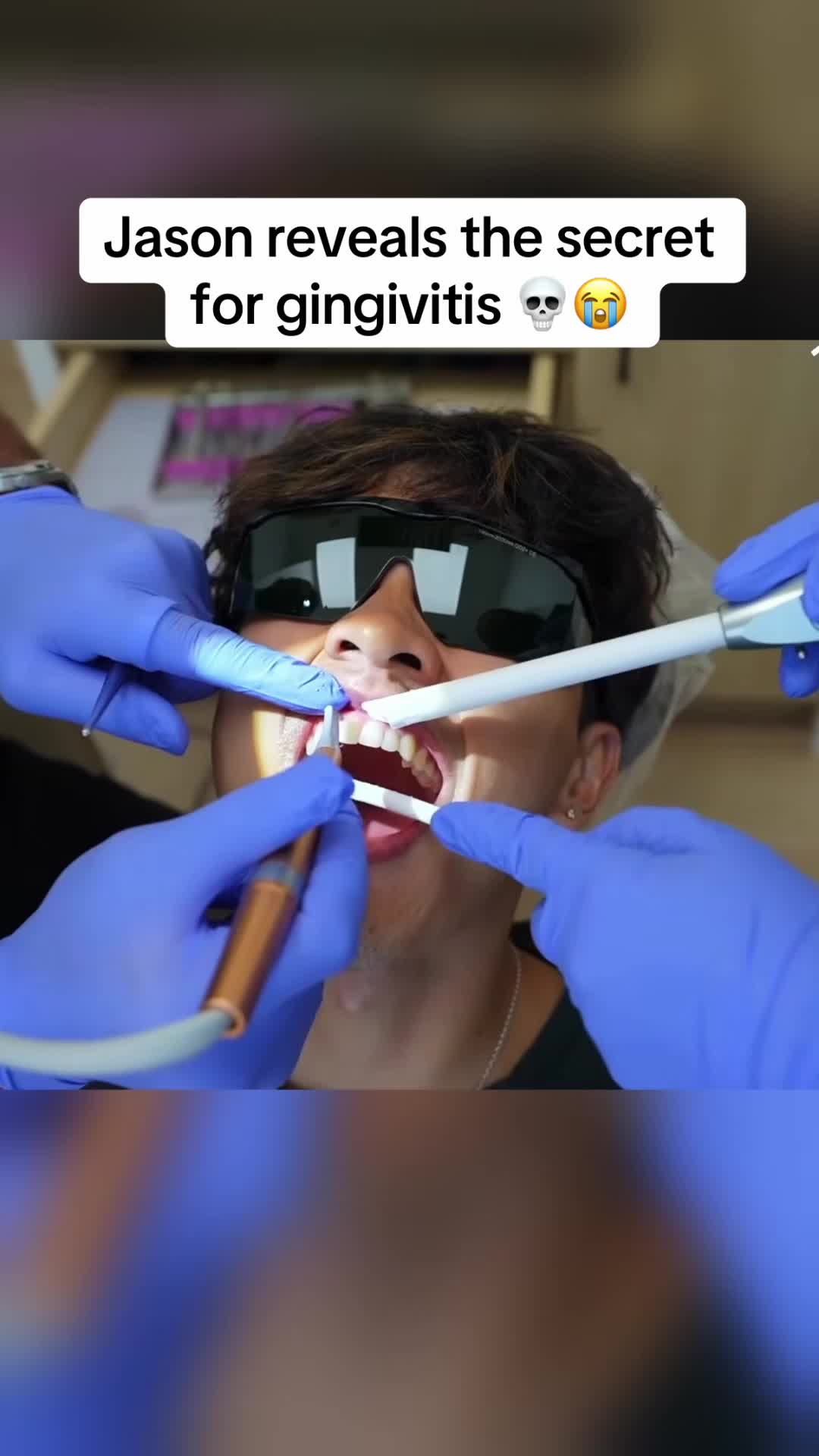TikTok post by @jsndeals for Gurunanda. Caption reads: [...] secret for gingivitis!! #gingivitis....