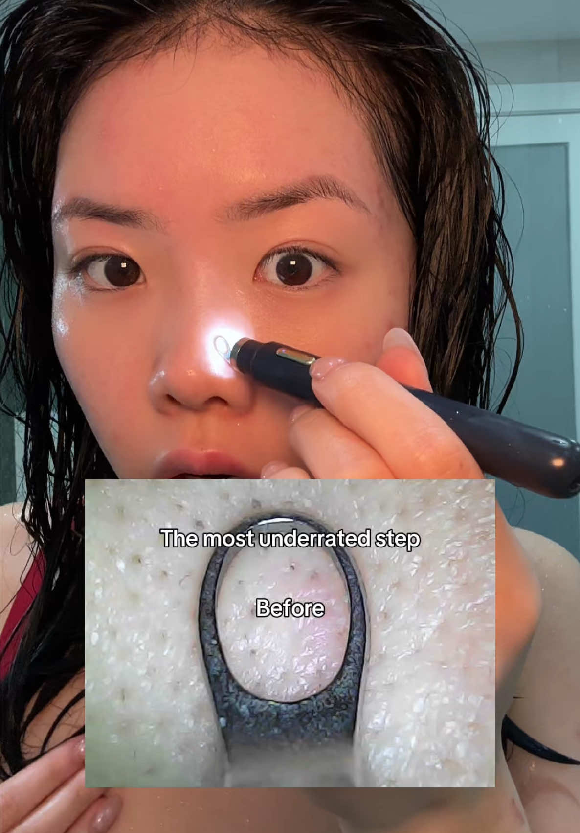 TikTok post by @bykristinanguyen for arencia. Caption reads: [...] actually CLEANSE! Acne ends here with....