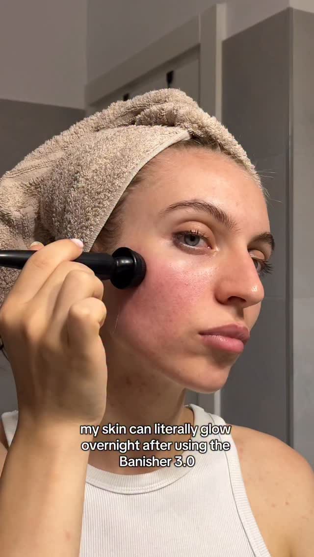 Instagram post by @ana_vaideanu for Banish. Caption reads: IN @banishacnescars WE TRUST 💗
Using the Banisher....