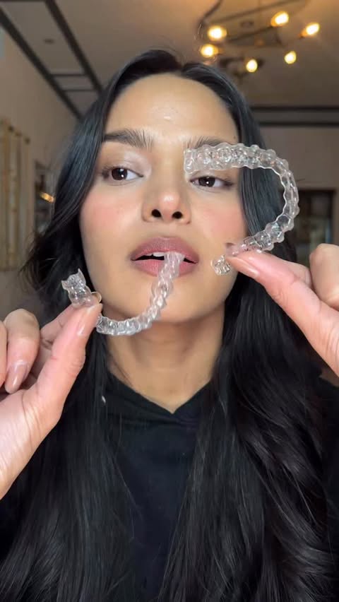 Instagram post by @generousglaamm for Invisalign. Caption reads: Update ⬇️ If you saw my first Invisalign video!....