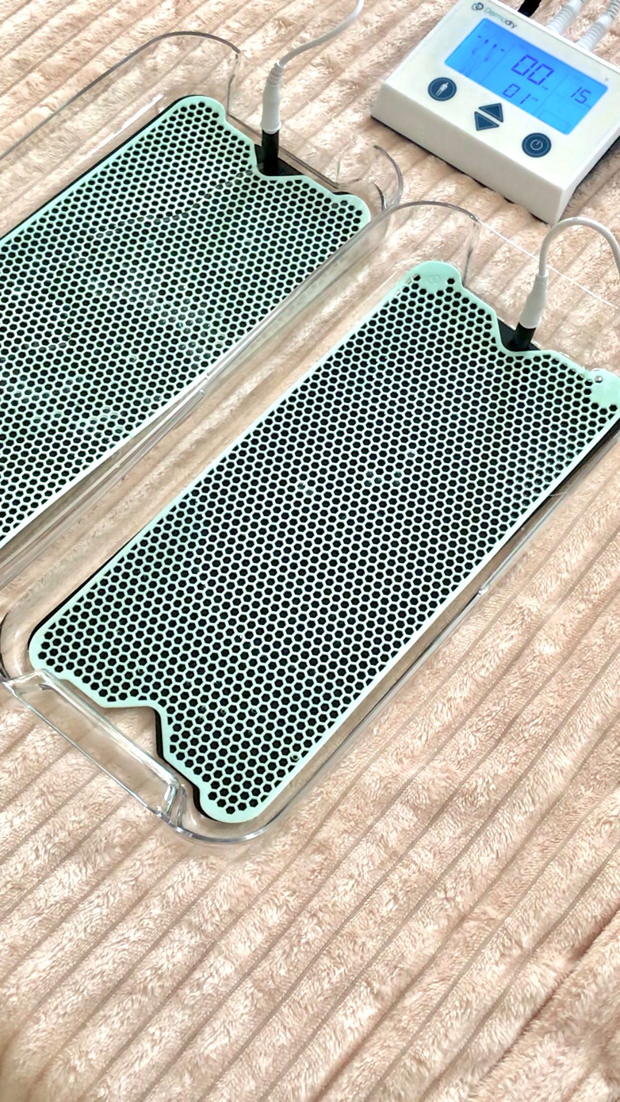 Instagram post by @eatwithirisss for Dermadry. Caption reads: 𝗦𝗮𝘆 𝗴𝗼𝗼𝗱𝗯𝘆𝗲 𝘁𝗼 𝗲𝘅𝗰𝗲𝘀𝘀𝗶𝘃𝗲....