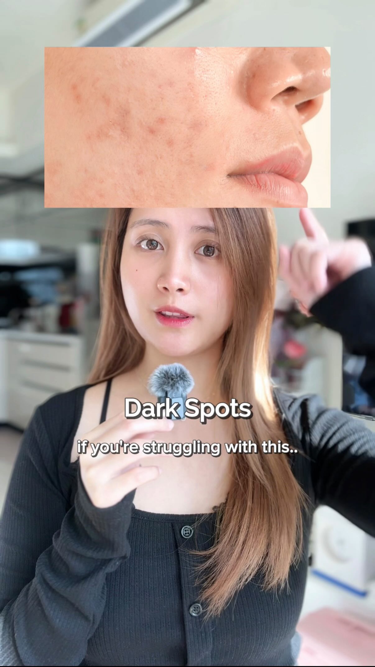 Instagram post by @trixjoyalcanar for Jumiso. Caption reads: Korean Dark Spot Remover for sensitive skin......