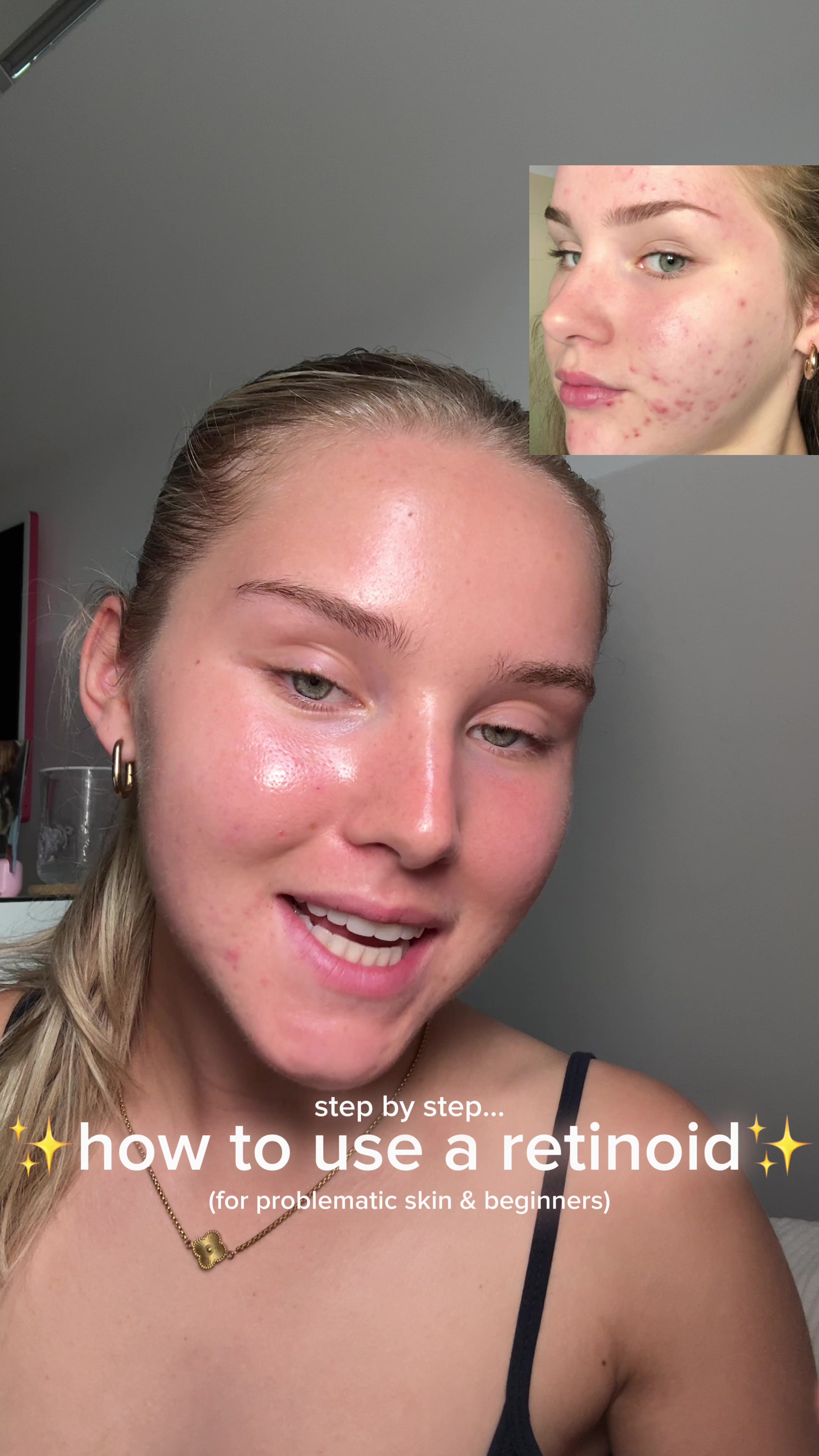 TikTok post by @lifewithmils for Dr Sam Bunting. Caption reads: EVERYTHING you need to know about retinoids⭐️ ad....