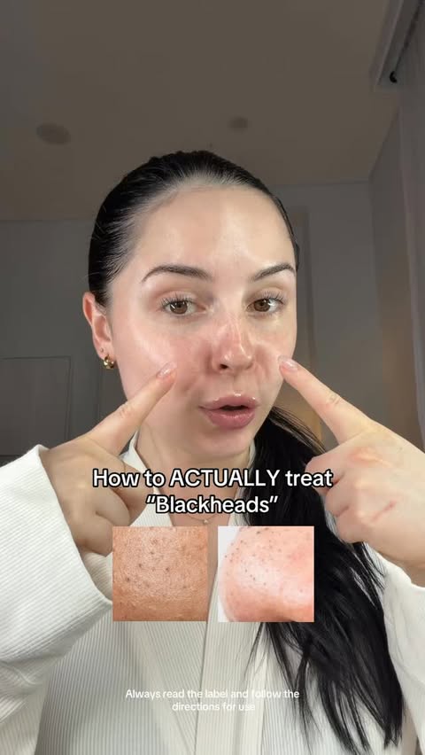 Instagram post by @misspeytonsmith for Chemist Warehouse. Caption reads: [...] Medicated Lotion is available at....