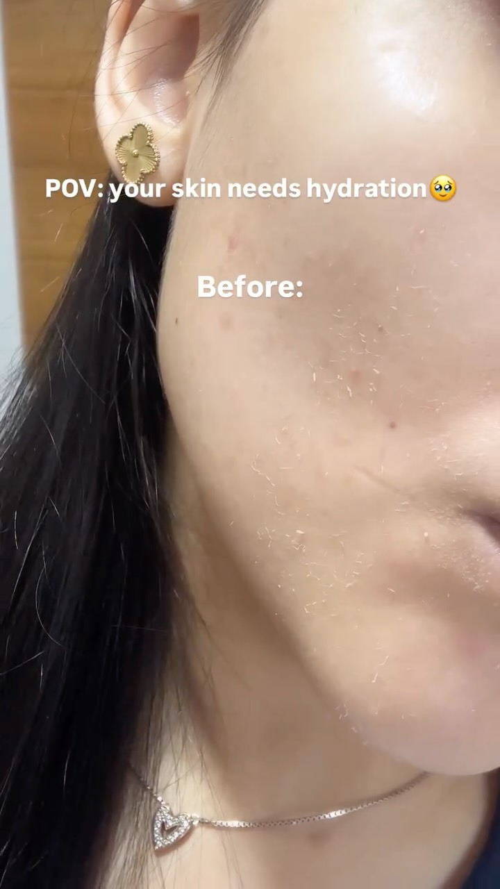 Instagram post by @yourbaevani for Torriden. Caption reads: Dehydrated, flaky skin literally stands no chance....