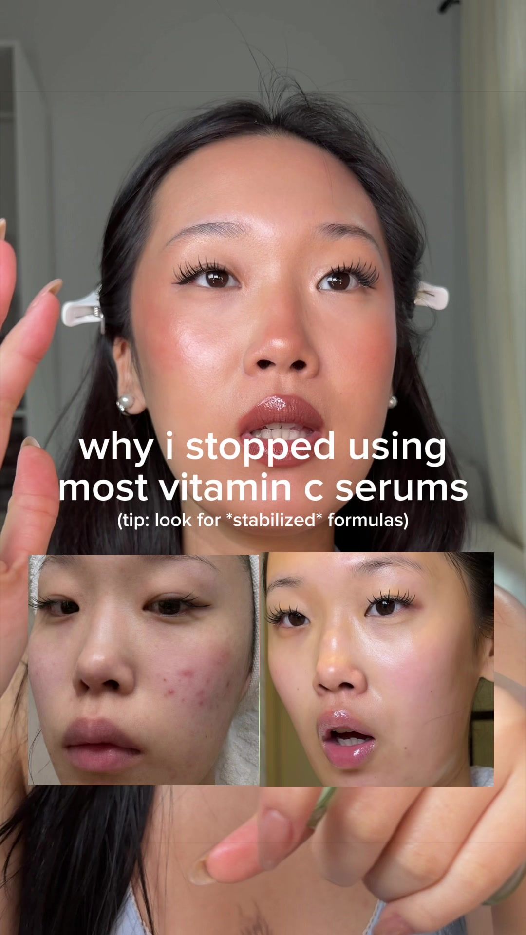 TikTok post by @via..li for Goodal USA. Caption reads: [...] break out from vitamin c serums @goodal USA....