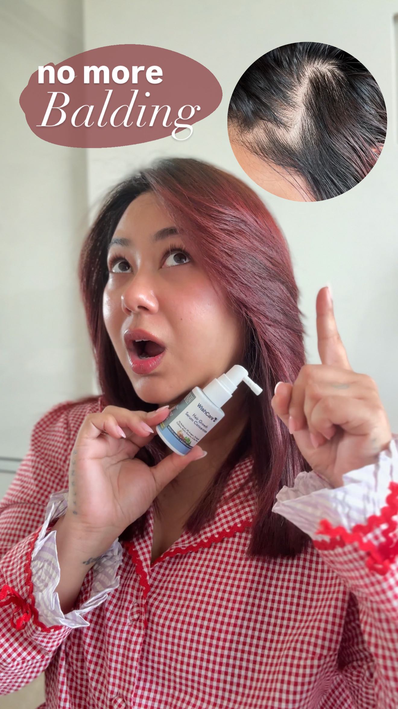 Instagram post by @thatquirkymiss for WishCare. Caption reads: Not to be dramatic but..this saved my scalp....
