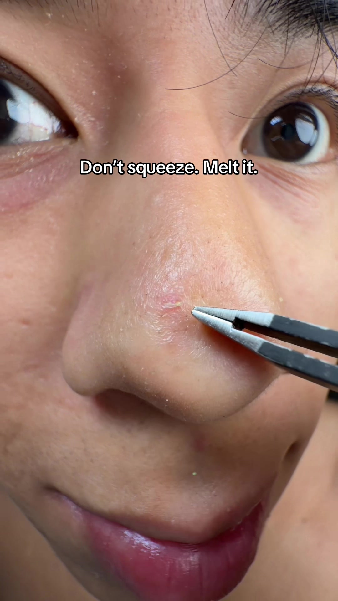 TikTok post by @ecdeals for Illinois Soybean Association. Caption reads: no more blackheads @ilso US #ilso #pores....