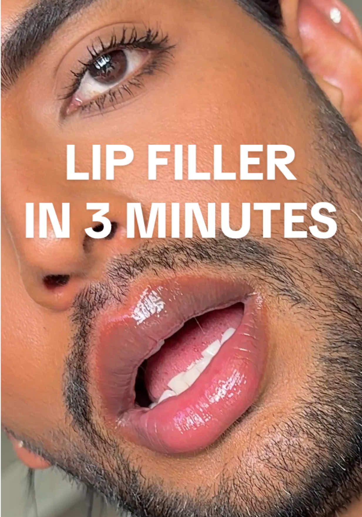 TikTok post by @adityamadiraju for RoC Skincare. Caption reads: 3 minute lip plumping without needles! 👀 Made my....