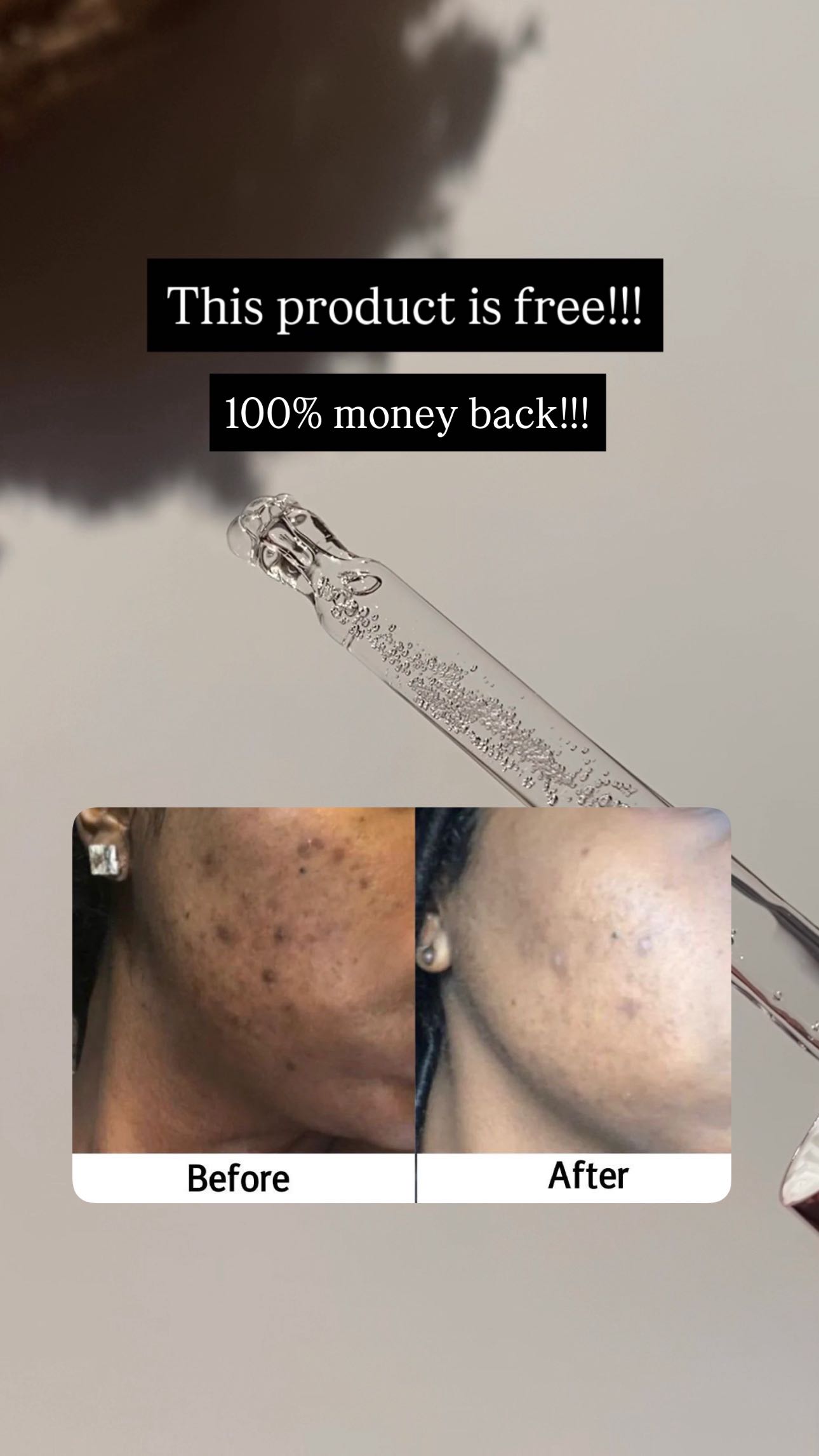 Instagram post by @kaluvaa_ for Chicnutrix. Caption reads: Ad

Personally tried & 100% recommended

Follow....