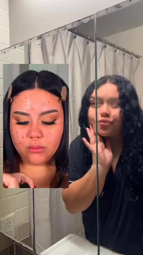 Instagram post by @crystalpagan for Curology. Caption reads: [...] has came such a long way thanks to....