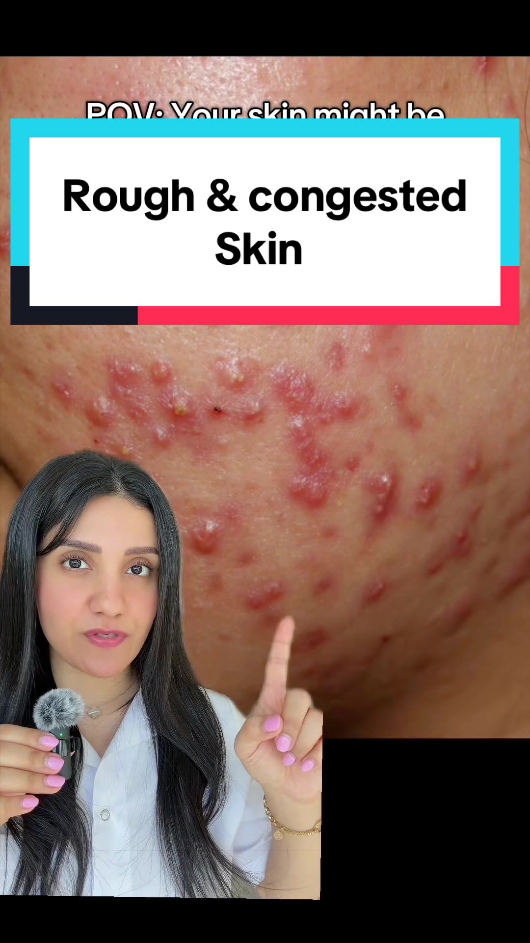 TikTok post by @dr.farzan for LAKA. Caption reads: [...] while keeping the skin balanced ✨ @Laka US....