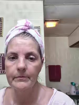 TikTok post by @robinwatson41 for ForChics. Caption reads: [...] seen amazing results from this serum....