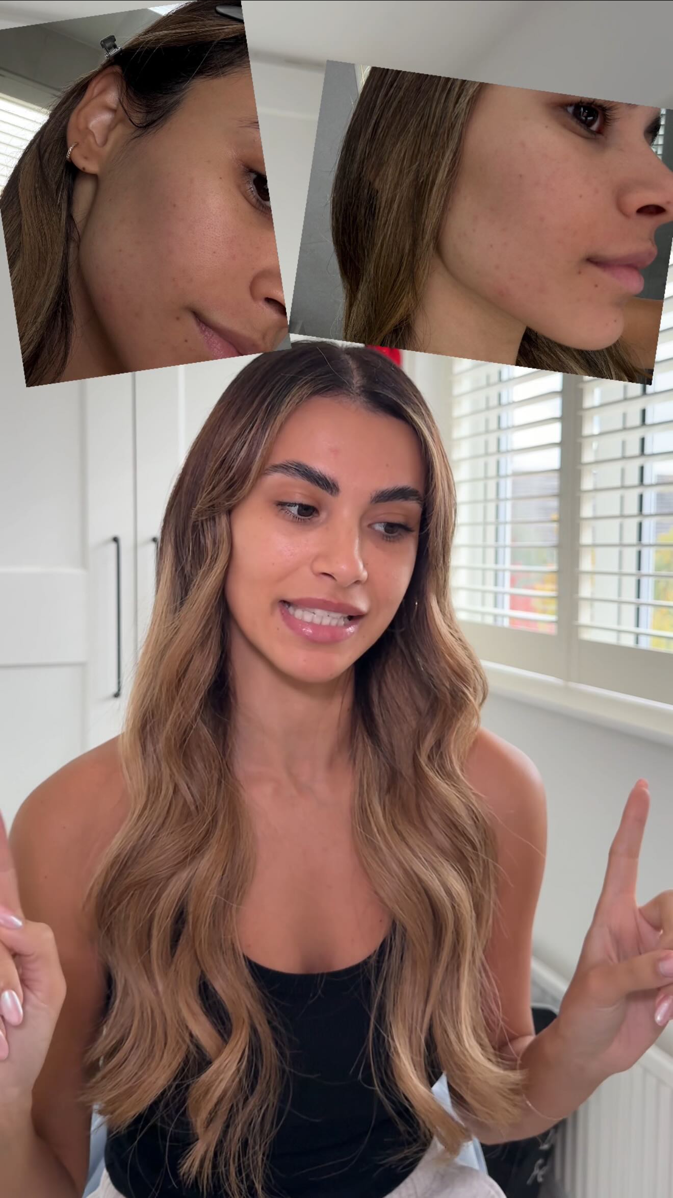 Instagram post by @joannachimonides for Dermatica. Caption reads: Let’s talk about our skin! I knew skincare was....